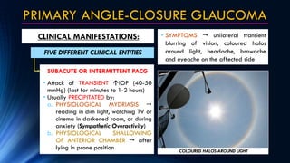 PRIMARY ANGLE-CLOSURE GLAUCOMA
CLINICAL MANIFESTATIONS:
FIVE DIFFERENT CLINICAL ENTITIES
• Attack of TRANSIENT IOP (40-50...