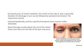 •During the pain of cluster headache, the nostril on the side of pain is generally
blocked; this blockage in turn can be followed by ipsilateral lacrimation. The
conjunctiva may be
•injected ipsilaterally, and the superficial temporal artery may be visibly
distended.
•Nasal drainage usually signals the end of the attack.
Ptosis and miosis on the side of the pain may occur
 