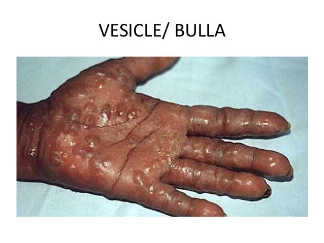 Primary Skin Lesions by Aseem