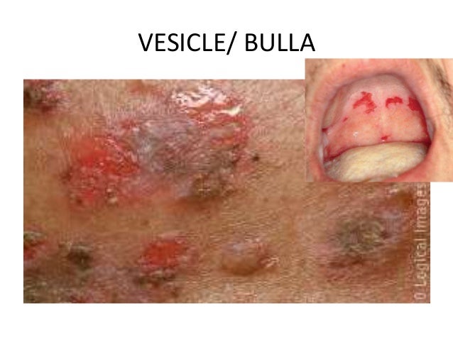 Primary Skin Lesions by Aseem