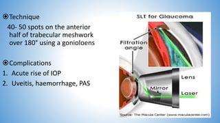 Primary open angle glaucoma | PPTX