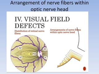 Primary open angle glaucoma | PPTX