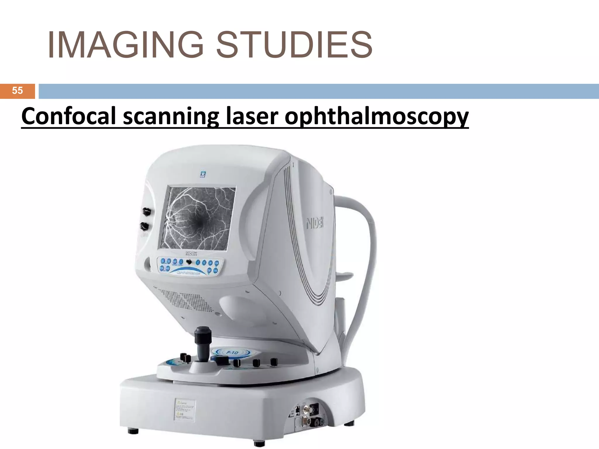 Primary open angle glaucoma(POAG) | PPTX