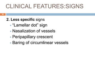 CLINICAL FEATURES:SIGNS
2. Less specific signs
 “Lamellar dot” sign
 Nasalization of vessels
 Peripapillary crescent
 Baring of circumlinear vessels
38
 