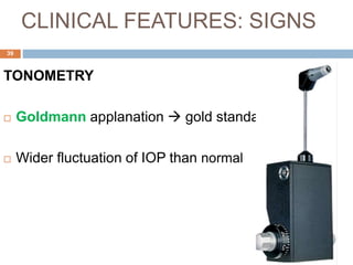 CLINICAL FEATURES: SIGNS
TONOMETRY
 Goldmann applanation  gold standard
 Wider fluctuation of IOP than normal
39
 