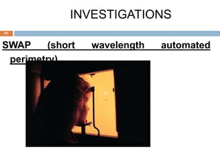 SWAP (short wavelength automated
perimetry)
INVESTIGATIONS
51
 