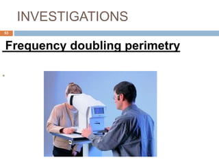 INVESTIGATIONS
Frequency doubling perimetry

53
 