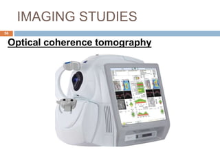 IMAGING STUDIES
Optical coherence tomography
56
 