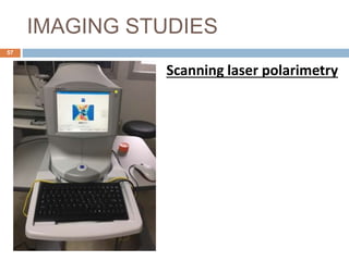 IMAGING STUDIES
Scanning laser polarimetry
57
 