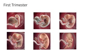 First Trimester
 