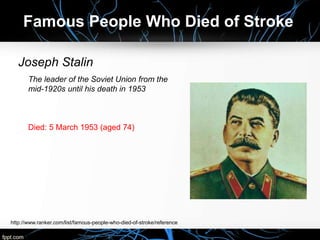 Joseph Stalin
The leader of the Soviet Union from the
mid-1920s until his death in 1953
Died: 5 March 1953 (aged 74)
Famous People Who Died of Stroke
http://www.ranker.com/list/famous-people-who-died-of-stroke/reference
 