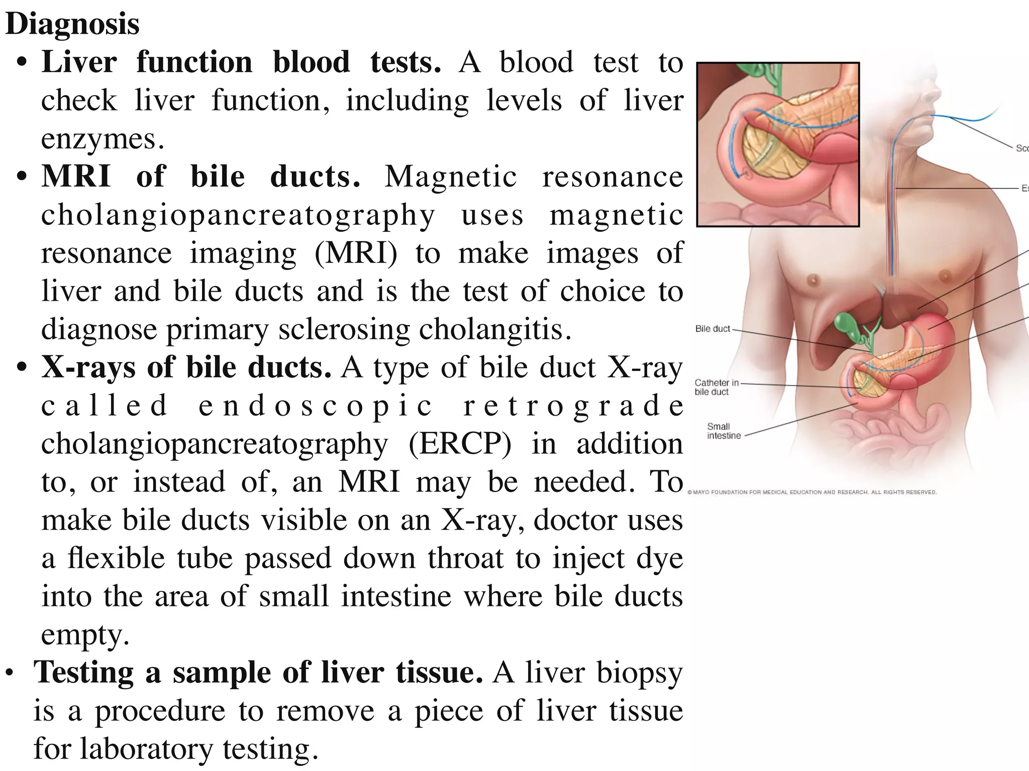 Diagnosi
s

•	
Liver function blood tests. A blood test to
check liver function, including levels of liver
enzymes
.

•	
MRI of bile ducts. Magnetic resonance
cholangiopancreatography uses magnetic
resonance imaging (MRI) to make images of
liver and bile ducts and is the test of choice to
diagnose primary sclerosing cholangitis
.

•	
X-rays of bile ducts. A type of bile duct X-ray
c a l l e d e n d o s c o p i c r e t r o g r a d e
cholangiopancreatography (ERCP) in addition
to, or instead of, an MRI may be needed. To
make bile ducts visible on an X-ray, doctor uses
a
fl
exible tube passed down throat to inject dye
into the area of small intestine where bile ducts
empty
.

• Testing a sample of liver tissue. A liver biopsy
is a procedure to remove a piece of liver tissue
for laboratory testing.
 