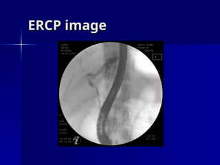 ERCP image
ERCP image
 