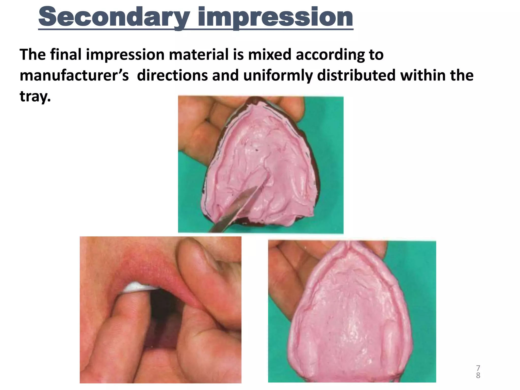 PRIMARY & SECONDARY IMPRESSION IN CD.ppt