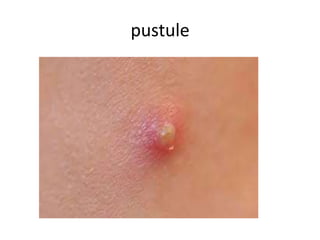 Comprehensive Overview of Primary, Secondary, and Special Skin Lesions ...