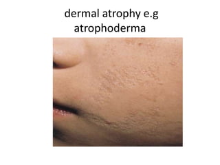 Comprehensive Overview of Primary, Secondary, and Special Skin Lesions ...