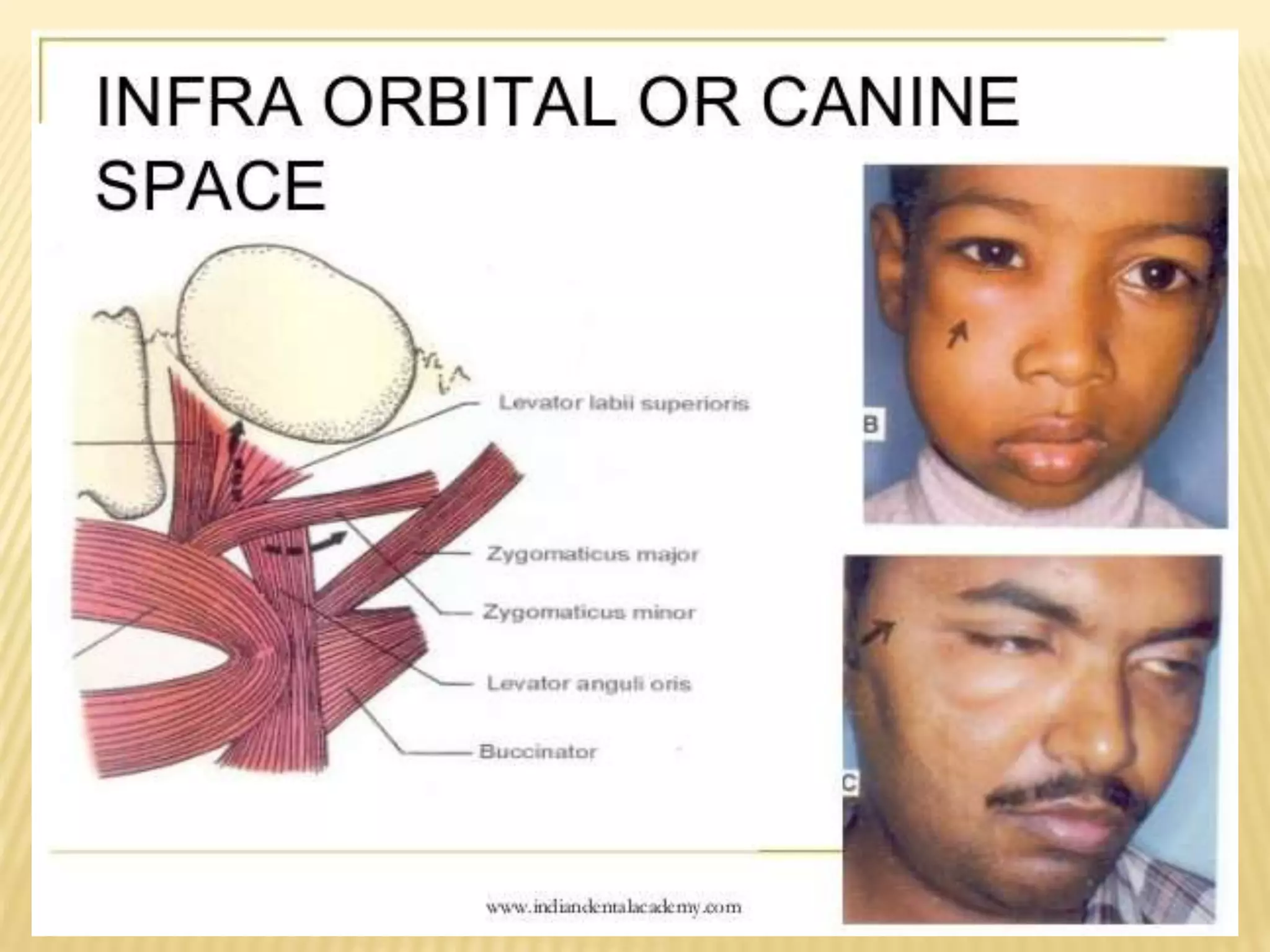 Primary spaces of space infection | PPTX