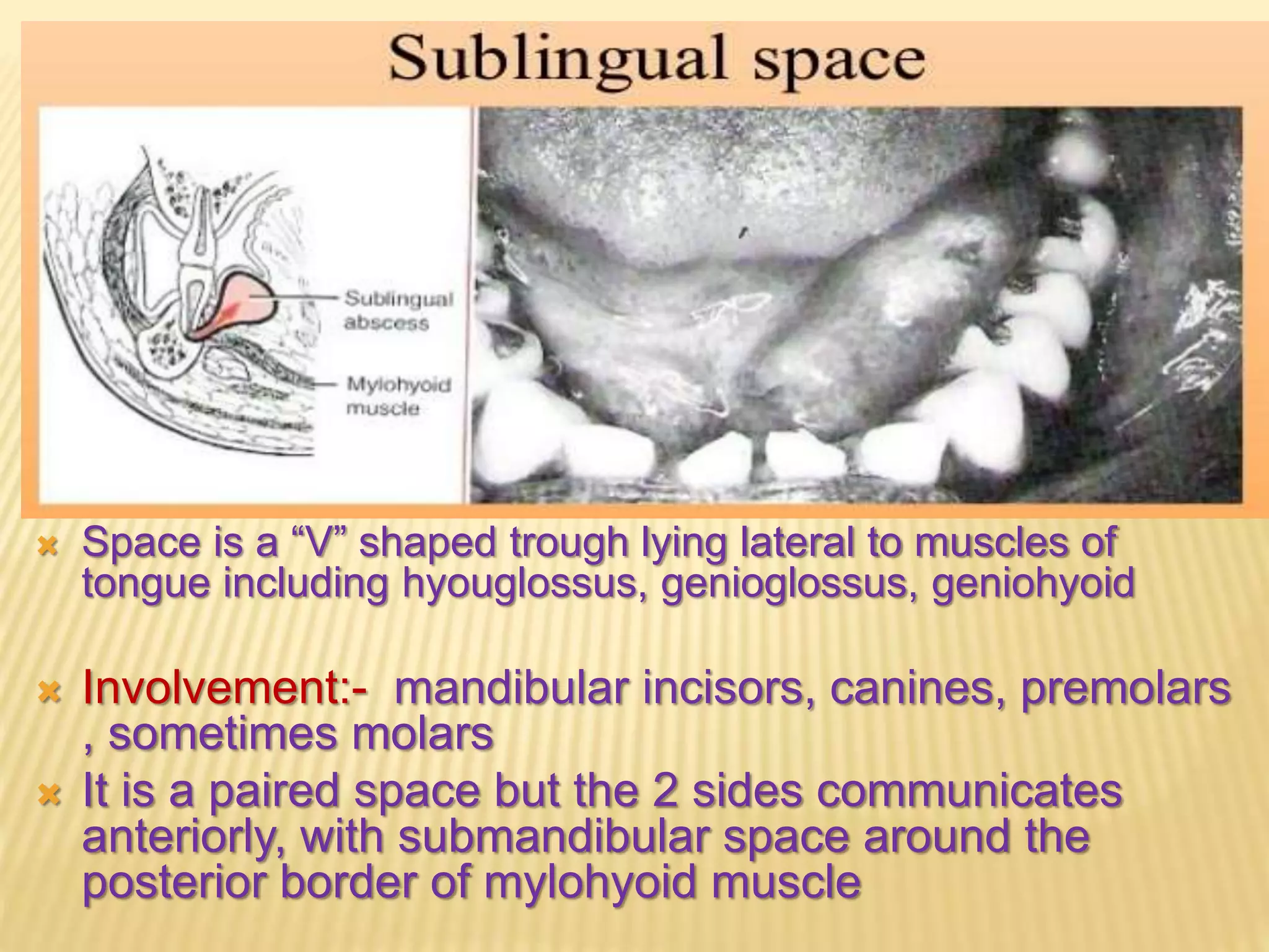 Primary spaces of space infection | PPTX