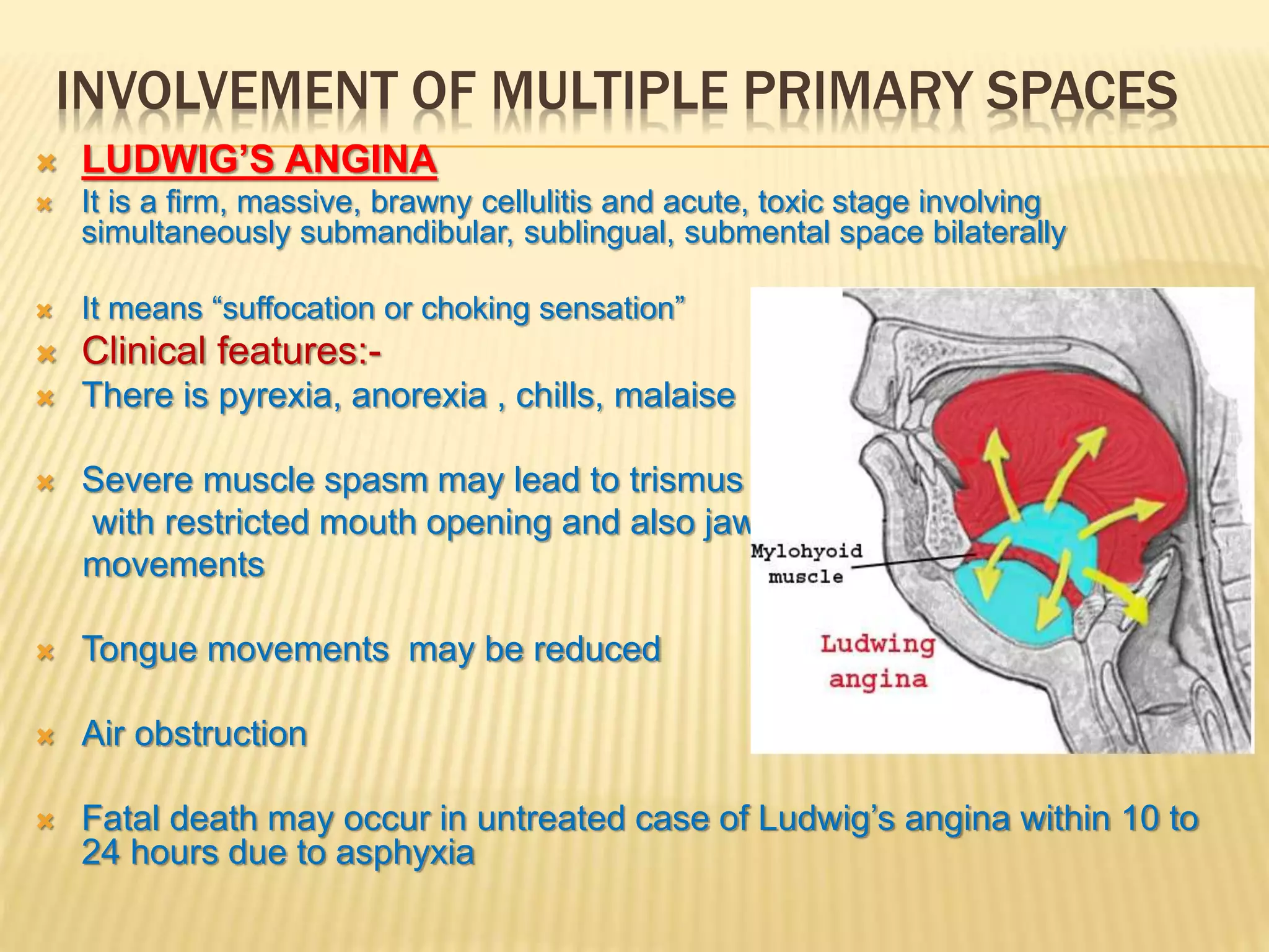 Primary spaces of space infection | PPTX