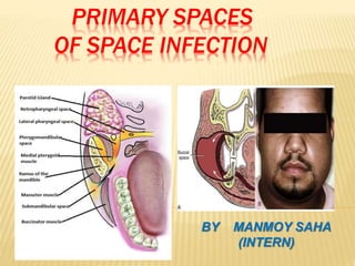 PRIMARY SPACES
OF SPACE INFECTION
BY MANMOY SAHA
(INTERN)
 