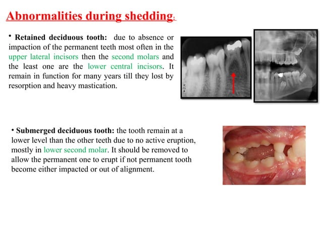 Primary teeth in Comparision to permanent dention .pptx | Oral care ...