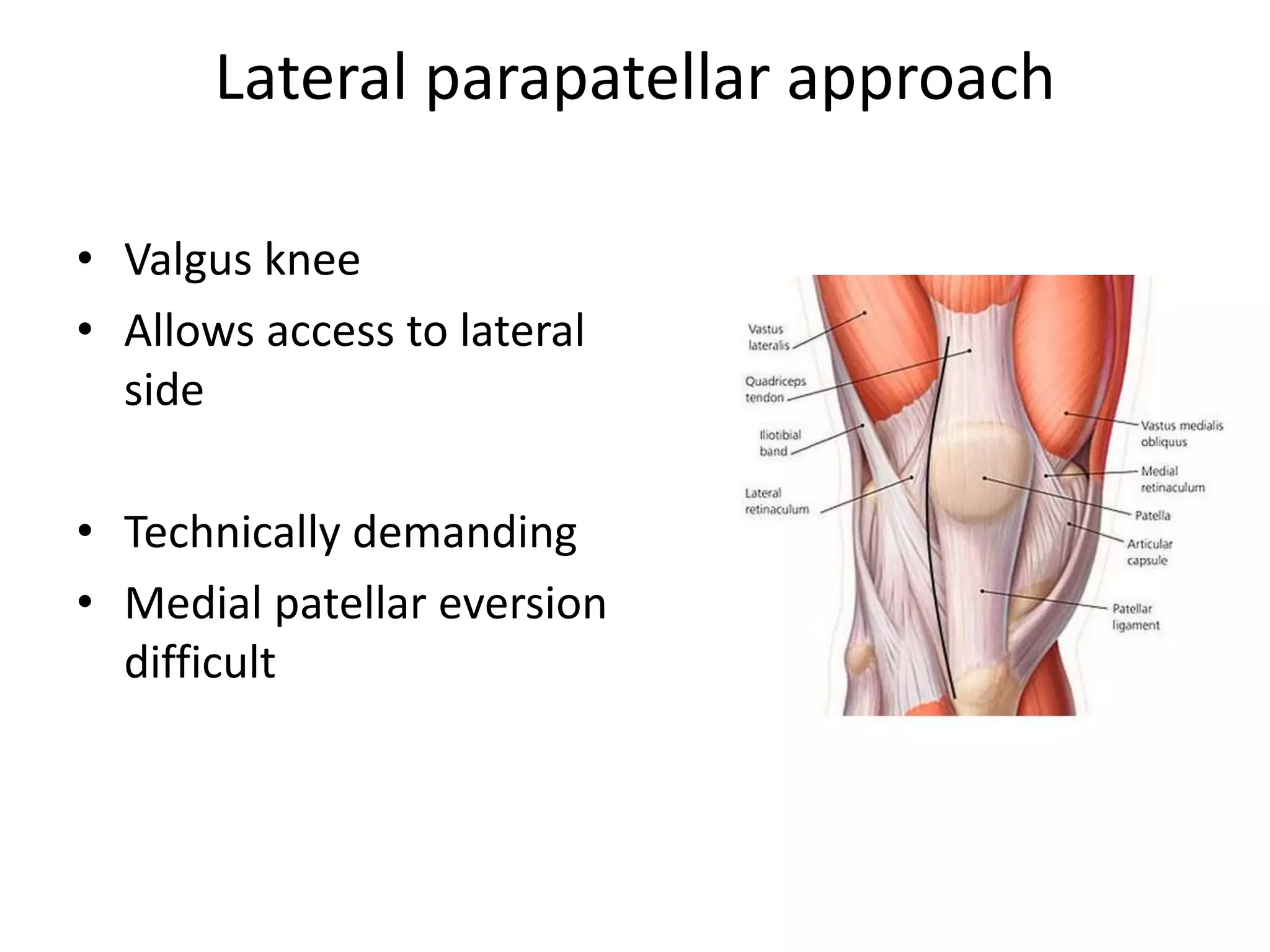Primary total knee arthroplasty | PPTX