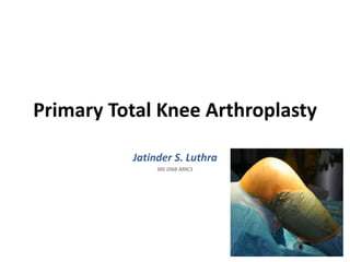 Primary Total Knee Arthroplasty
Jatinder S. Luthra
MS DNB MRCS
 