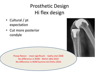 Prosthetic Design
Hi flex design
• Cultural / pt
expectation
• Cut more posterior
condyle
Preop flexion - most significant - Gatha etal 2008
No difference in ROM - Mehin JBJS 2010
No difference in ROM Sumino Int Ortho 2010
 