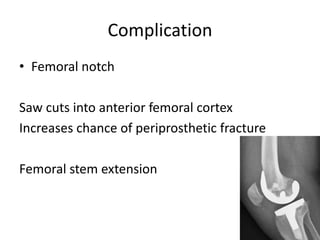 Complication
• Femoral notch
Saw cuts into anterior femoral cortex
Increases chance of periprosthetic fracture
Femoral stem extension
 