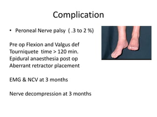 Complication
• Peroneal Nerve palsy ( .3 to 2 %)
Pre op Flexion and Valgus def
Tourniquete time > 120 min.
Epidural anaesthesia post op
Aberrant retractor placement
EMG & NCV at 3 months
Nerve decompression at 3 months
 