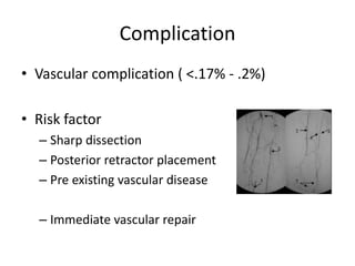 Complication
• Vascular complication ( <.17% - .2%)
• Risk factor
– Sharp dissection
– Posterior retractor placement
– Pre existing vascular disease
– Immediate vascular repair
 