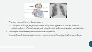 Hunger Neck Primary trauma care | PPTX