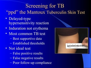 Primary Tuberculosis 1 | PPT