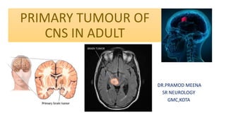 PRIMARY TUMOUR OF
CNS IN ADULT
DR.PRAMOD MEENA
SR NEUROLOGY
GMC,KOTA
 