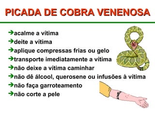 PICADA DE COBRA VENENOSAPICADA DE COBRA VENENOSA
acalme a vítima
deite a vítima
aplique compressas frias ou gelo
transporte imediatamente a vítima
não deixe a vítima caminhar
não dê álcool, querosene ou infusões à vítima
não faça garroteamento
não corte a pele
 