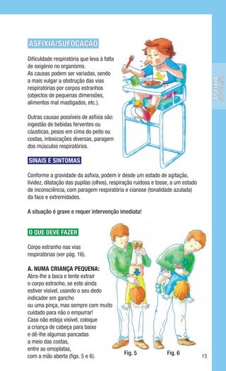 ASFIXIA/SUFOCAÇÃO
Dificuldade respiratória que leva à falta
de oxigénio no organismo.
As causas podem ser variadas, sendo




                                                                                             sufocação
                                                                                       Asfixia
a mais vulgar a obstrução das vias
respiratórias por corpos estranhos
(objectos de pequenas dimensões,
alimentos mal mastigados, etc.).

Outras causas possíveis de asfixia são:
ingestão de bebidas ferventes ou
cáusticas, pesos em cima do peito ou
costas, intoxicações diversas, paragem
dos músculos respiratórios.

SINAIS E SINTOMAS

Conforme a gravidade da asfixia, podem ir desde um estado de agitação,
lividez, dilatação das pupilas (olhos), respiração ruidosa e tosse, a um estado
de inconsciência, com paragem respiratória e cianose (tonalidade azulada)
da face e extremidades.

A situação é grave e requer intervenção imediata!


O QUE DEVE FAZER

Corpo estranho nas vias
respiratórias (ver pág. 16).

A. Numa criança pequena:
Abra-lhe a boca e tente extrair
o corpo estranho, se este ainda
estiver visível, usando o seu dedo
indicador em gancho
ou uma pinça, mas sempre com muito
cuidado para não o empurrar!
Caso não esteja visível, coloque
a criança de cabeça para baixo
e dê-lhe algumas pancadas
a meio das costas,
entre as omoplatas,
                                             Fig. 5              Fig. 6
com a mão aberta (figs. 5 e 6).                                                   13
 