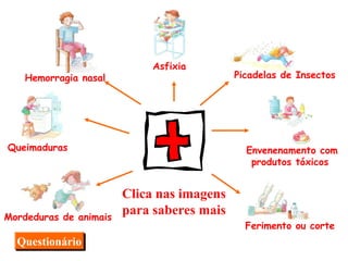 Clica nas imagens para saberes mais Questionário Asfixia Picadelas de Insectos Envenenamento com produtos tóxicos Ferimento ou corte Mordeduras de animais Queimaduras Hemorragia nasal 