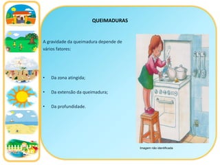 QUEIMADURAS A gravidade da queimadura depende de  vários fatores: Da zona atingida; Da extensão da queimadura;  Da profundidade. Imagem não identificada 