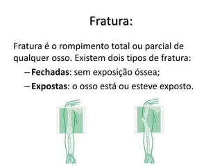 Fratura:
Fratura é o rompimento total ou parcial de
qualquer osso. Existem dois tipos de fratura:
   – Fechadas: sem exposição óssea;
   – Expostas: o osso está ou esteve exposto.
 