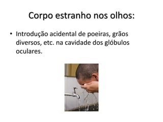 Corpo estranho nos olhos:
• Introdução acidental de poeiras, grãos
  diversos, etc. na cavidade dos glóbulos
  oculares.
 