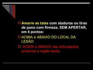 Amarre as talas  com ataduras ou tiras de pano com firmeza, SEM APERTAR, em 4 pontos:   ACIMA e ABAIXO DO LOCAL DA LESÃO ACIMA e ABAIXO das articulações próximas à região lesão.  