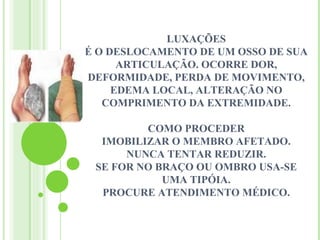 LUXAÇÕES
É O DESLOCAMENTO DE UM OSSO DE SUA
      ARTICULAÇÃO. OCORRE DOR,
DEFORMIDADE, PERDA DE MOVIMENTO,
     EDEMA LOCAL, ALTERAÇÃO NO
   COMPRIMENTO DA EXTREMIDADE.

         COMO PROCEDER
  IMOBILIZAR O MEMBRO AFETADO.
      NUNCA TENTAR REDUZIR.
 SE FOR NO BRAÇO OU OMBRO USA-SE
            UMA TIPÓIA.
  PROCURE ATENDIMENTO MÉDICO.
 