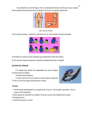 16
       Na persistência da hemorragia, inicie a compressão direta da artéria que irriga a região.
Os principais pontos arteriais são os braquiais, femorais e temporais superficiais.




                                        Não utilize torniquete.

3) Em caso de choque - posicione o paciente com as extremidades inferiores elevada.




4) Imobilize as fraturas exceto naqueles que apresentem sinais de choque.

5) Em caso de choque transporte o paciente imediatamente para o hospital.


ESTADO DE CHOQUE

     É o estado que resulta da incapacidade em prover sangue
suficiente para os órgãos.
     Pressão Arterial sistólica
     A causa mais comum de choque é a hemorragia. A perda de
1,5 litro ou mais de sangue pode produzir choque.


Causas

   Perda líquida (desidratação) ou sangramento (Trauma - hemorragia) importante - são as
  causas mais freqüentes;
 Infarto agudo do miocárdio em adultos: 40 anos é causa mais freqüente de choque;
 Infecção severa;
  Queimadura grave e outros.
 