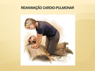 REANIMAÇÃO CARDIO-PULMONAR
 