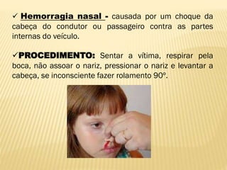  Hemorragia nasal - causada por um choque da
cabeça do condutor ou passageiro contra as partes
internas do veículo.
PROCEDIMENTO: Sentar a vítima, respirar pela
boca, não assoar o nariz, pressionar o nariz e levantar a
cabeça, se inconsciente fazer rolamento 90º.
 