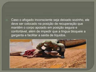 III. Caso o afogado inconsciente seja deixado sozinho, ele 
deve ser colocado na posição de recuperação que 
mantêm o corpo apoiado em posição segura e 
confortável, além de impedir que a língua bloqueie a 
garganta e facilitar a saída de líquidos. 
 