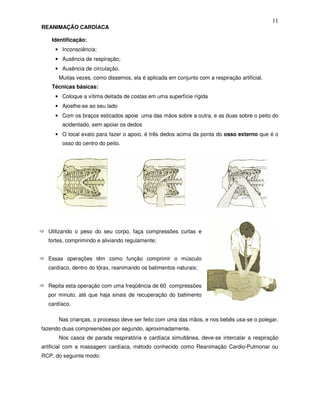 11
REANIMAÇÃO CARDÍACA
Identificação:
• Inconsciência;
• Ausência de respiração;
• Ausência de circulação.
Muitas vezes, como dissemos, ela é aplicada em conjunto com a respiração artificial.
Técnicas básicas:
• Coloque a vítima deitada de costas em uma superfície rígida
• Ajoelhe-se ao seu lado
• Com os braços esticados apoie uma das mãos sobre a outra, e as duas sobre o peito do
acidentado, sem apoiar os dedos
• O local exato para fazer o apoio, é três dedos acima da ponta do osso externo que é o
osso do centro do peito.
Utilizando o peso do seu corpo, faça compressões curtas e
fortes, comprimindo e aliviando regulamente;
Essas operações têm como função comprimir o músculo
cardíaco, dentro do tórax, reanimando os batimentos naturais;
Repita esta operação com uma freqüência de 60 compressões
por minuto, até que haja sinais de recuperação do batimento
cardíaco.
Nas crianças, o processo deve ser feito com uma das mãos, e nos bebês usa-se o polegar,
fazendo duas compreensões por segundo, aproximadamente.
Nos casos de parada respiratória e cardíaca simultânea, deve-se intercalar a respiração
artificial com a massagem cardíaca, método conhecido como Reanimação Cardio-Pulmonar ou
RCP, do seguinte modo:
 