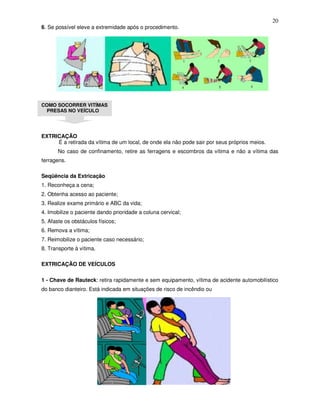 20
6. Se possível eleve a extremidade após o procedimento.
COMO SOCORRER VITÍMAS
PRESAS NO VEÍCULO
EXTRICAÇÃO
É a retirada da vítima de um local, de onde ela não pode sair por seus próprios meios.
No caso de confinamento, retire as ferragens e escombros da vítima e não a vítima das
ferragens.
Seqüência da Extricação
1. Reconheça a cena;
2. Obtenha acesso ao paciente;
3. Realize exame primário e ABC da vida;
4. Imobilize o paciente dando prioridade a coluna cervical;
5. Afaste os obstáculos físicos;
6. Remova a vítima;
7. Reimobilize o paciente caso necessário;
8. Transporte à vítima.
EXTRICAÇÃO DE VEÍCULOS
1 - Chave de Rauteck: retira rapidamente e sem equipamento, vítima de acidente automobilístico
do banco dianteiro. Está indicada em situações de risco de incêndio ou
 