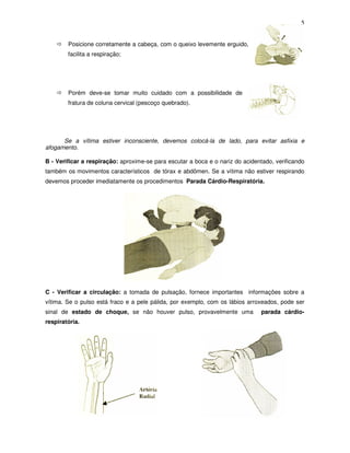 5
Posicione corretamente a cabeça, com o queixo levemente erguido,
facilita a respiração;
Porém deve-se tomar muito cuidado com a possibilidade de
fratura de coluna cervical (pescoço quebrado).
Se a vítima estiver inconsciente, devemos colocá-la de lado, para evitar asfixia e
afogamento.
B - Verificar a respiração: aproxime-se para escutar a boca e o nariz do acidentado, verificando
também os movimentos característicos de tórax e abdômen. Se a vítima não estiver respirando
devemos proceder imediatamente os procedimentos Parada Cárdio-Respiratória.
C - Verificar a circulação: a tomada de pulsação, fornece importantes informações sobre a
vítima. Se o pulso está fraco e a pele pálida, por exemplo, com os lábios arroxeados, pode ser
sinal de estado de choque, se não houver pulso, provavelmente uma parada cárdio-
respiratória.
 