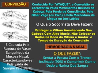 CONVULSÃO Conhecida Por “ATAQUE”, a Convulsão se
Caracteriza Pelos Movimentos Bruscos da
Cabeça, Pela Perda de Consciência, Pelo
Olhar Vago (ou Fixo) e Pela Mordedura da
Língua ou Dos Lábios
O Que o Socorrista Deve Fazer?:
Proteger a Vítima Amortecendo Sua
Cabeça Com Algo Macio. Não Colocar os
Dedos na Boca da Vítima e Anotar o
Tempo de Duração da Convulsão
HEMORRAGIA NASAL
É Causada Pela
Ruptura de Vasos
Sanguíneos da
Mucosa Nasal,
Caracterizando-se
Pela Saída de
Sangue Pelo Nariz
O QUE FAZER?:
Sentar a Pessoa Com o Tronco
Inclinado (90%) e Comprimir Com o
Dedo a Narina Que Sangra
 